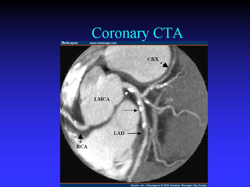 Coronary CTA